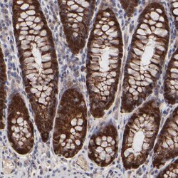 Invitrogen FRMD8 Polyclonal Antibody 100 &mu;L | Buy Online | Invitrogen&trade; | Fisher Scientific