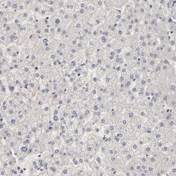 Invitrogen FRMD8 Polyclonal Antibody 100 &mu;L | Buy Online | Invitrogen&trade; | Fisher Scientific