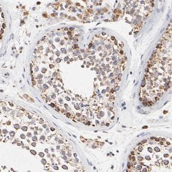 Invitrogen SSBP1 Polyclonal Antibody 100 &mu;L; Unconjugated:Antibodies,