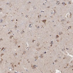 Invitrogen SSBP1 Polyclonal Antibody 100 &mu;L; Unconjugated:Antibodies,