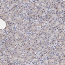 Invitrogen SSBP1 Polyclonal Antibody 100 &mu;L; Unconjugated:Antibodies,
