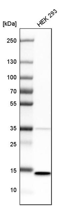 Invitrogen SSBP1 Polyclonal Antibody 100 &mu;L; Unconjugated:Antibodies,