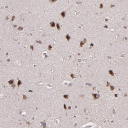 Invitrogen ABHD12B Polyclonal Antibody 100 &mu;L; Unconjugated:Antibodies,