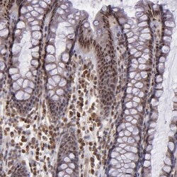 Invitrogen ABHD12B Polyclonal Antibody 100 &mu;L; Unconjugated:Antibodies,