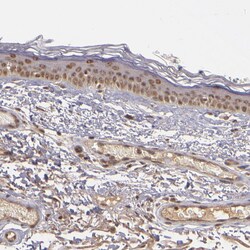 Invitrogen ABHD12B Polyclonal Antibody 100 &mu;L; Unconjugated:Antibodies,