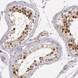 Invitrogen ABHD12B Polyclonal Antibody 100 &mu;L; Unconjugated:Antibodies,