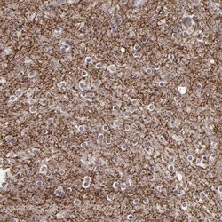 Invitrogen SIPA1L1 Polyclonal Antibody 100 &mu;L; Unconjugated:Antibodies,