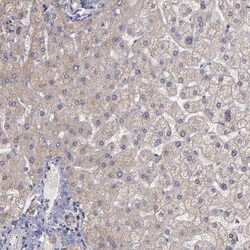 Invitrogen SIPA1L1 Polyclonal Antibody 100 &mu;L; Unconjugated:Antibodies,