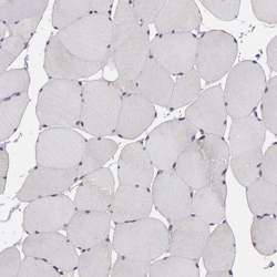 Invitrogen SIPA1L1 Polyclonal Antibody 100 &mu;L; Unconjugated:Antibodies,