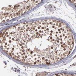 Invitrogen SIPA1L1 Polyclonal Antibody 100 &mu;L; Unconjugated:Antibodies,