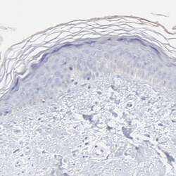 Invitrogen S100A12 Polyclonal Antibody 100 &mu;L; Unconjugated:Antibodies,