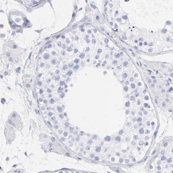 Invitrogen S100A12 Polyclonal Antibody 100 &mu;L; Unconjugated:Antibodies,