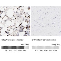 Invitrogen S100A12 Polyclonal Antibody 100 &mu;L; Unconjugated:Antibodies,
