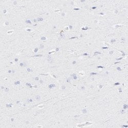 Invitrogen S100A12 Polyclonal Antibody 100 &mu;L; Unconjugated:Antibodies,