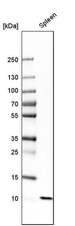 Invitrogen S100A12 Polyclonal Antibody 100 &mu;L; Unconjugated:Antibodies,