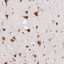 Invitrogen BEGAIN Polyclonal Antibody 100 &mu;L; Unconjugated:Antibodies,