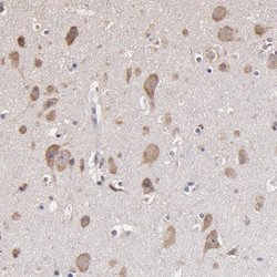 Invitrogen OPHN1 Polyclonal Antibody 100 &mu;L; Unconjugated:Antibodies,