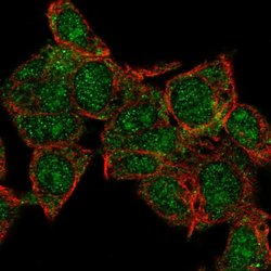 Invitrogen HECTD1 Polyclonal Antibody 100 &mu;L; Unconjugated:Antibodies,