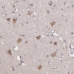 Invitrogen HECTD1 Polyclonal Antibody 100 &mu;L; Unconjugated:Antibodies,