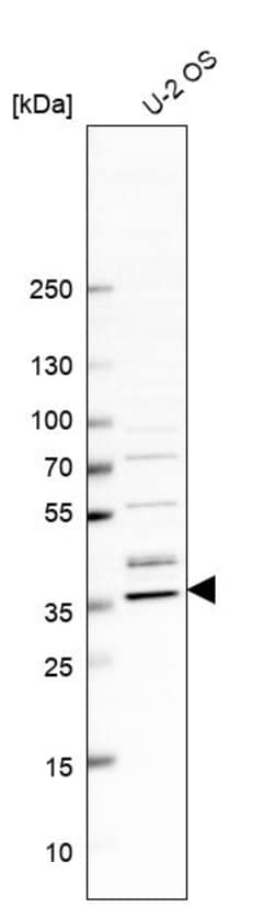 Invitrogen CGRRF1 Polyclonal Antibody 100 &mu;L; Unconjugated:Antibodies,