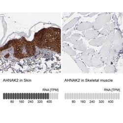 Invitrogen AHNAK2 Polyclonal Antibody 100 &mu;L; Unconjugated:Antibodies,