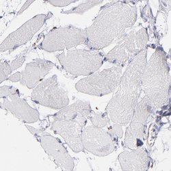 Invitrogen AHNAK2 Polyclonal Antibody 100 &mu;L; Unconjugated:Antibodies,