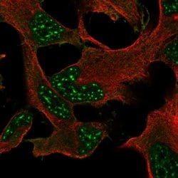 Invitrogen DRP2 Polyclonal Antibody 100 &mu;L; Unconjugated:Antibodies,