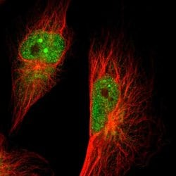 Invitrogen GMFB Polyclonal Antibody 100 &mu;L; Unconjugated:Antibodies,