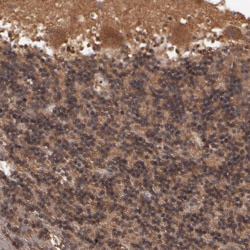 Invitrogen GMFB Polyclonal Antibody 100 &mu;L; Unconjugated:Antibodies,