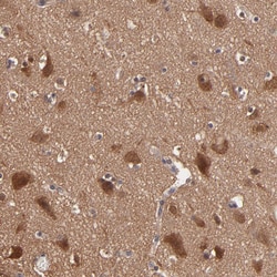 Invitrogen GMFB Polyclonal Antibody 100 &mu;L; Unconjugated:Antibodies,