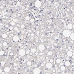 Invitrogen GMFB Polyclonal Antibody 100 &mu;L; Unconjugated:Antibodies,