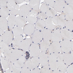 Invitrogen GMFB Polyclonal Antibody 100 &mu;L; Unconjugated:Antibodies,