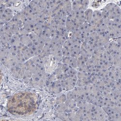 Invitrogen CEP97 Polyclonal Antibody 100 &mu;L; Unconjugated:Antibodies,