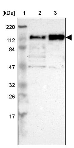 Invitrogen CEP97 Polyclonal Antibody 100 &mu;L; Unconjugated:Antibodies,