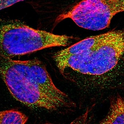 Invitrogen ELP2 Polyclonal Antibody 100 &mu;L; Unconjugated:Antibodies,