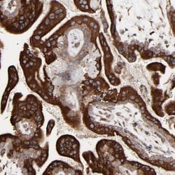 Invitrogen ELP2 Polyclonal Antibody 100 &mu;L; Unconjugated:Antibodies,