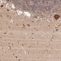 Invitrogen DLST Polyclonal Antibody 100 &mu;L; Unconjugated:Antibodies,