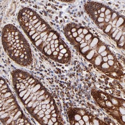 Invitrogen DLST Polyclonal Antibody 100 &mu;L; Unconjugated:Antibodies,