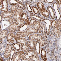 Invitrogen DLST Polyclonal Antibody 100 &mu;L; Unconjugated:Antibodies,