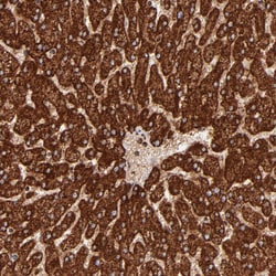 Invitrogen DLST Polyclonal Antibody 100 &mu;L; Unconjugated:Antibodies,