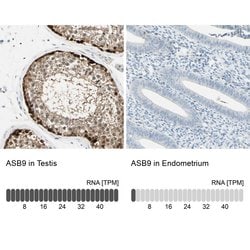 Invitrogen ASB9 Polyclonal Antibody 100 &mu;L; Unconjugated:Antibodies,