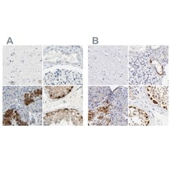 Invitrogen ASB9 Polyclonal Antibody 100 &mu;L; Unconjugated:Antibodies,