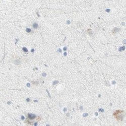 Invitrogen ASB9 Polyclonal Antibody 100 &mu;L; Unconjugated:Antibodies,