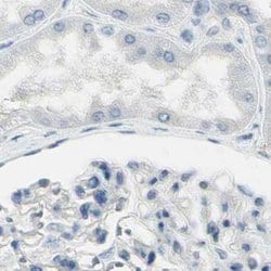 Invitrogen ASB9 Polyclonal Antibody 100 &mu;L; Unconjugated:Antibodies,