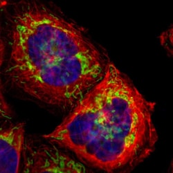 Invitrogen TOMM22 Polyclonal Antibody 100 &mu;L | Buy Online | Invitrogen&trade; | Fisher Scientific