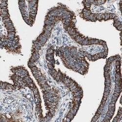 Invitrogen TOMM22 Polyclonal Antibody 100 &mu;L | Buy Online | Invitrogen&trade; | Fisher Scientific