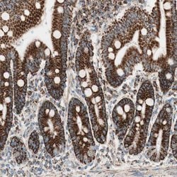 Invitrogen TOMM22 Polyclonal Antibody 100 &mu;L | Buy Online | Invitrogen&trade; | Fisher Scientific