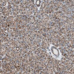 Invitrogen TOMM22 Polyclonal Antibody 100 &mu;L | Buy Online | Invitrogen&trade; | Fisher Scientific