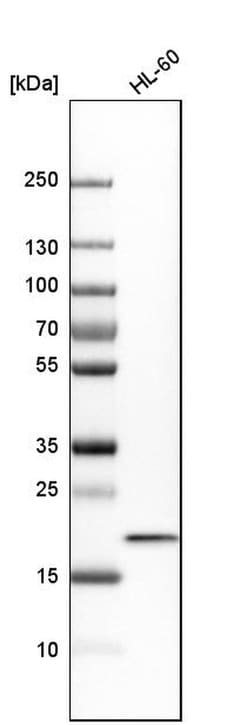 Invitrogen TOMM22 Polyclonal Antibody 100 &mu;L | Buy Online | Invitrogen&trade; | Fisher Scientific