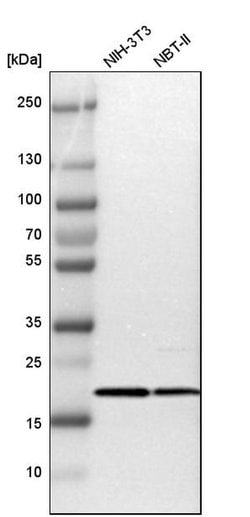 Invitrogen TOMM22 Polyclonal Antibody 100 &mu;L | Buy Online | Invitrogen&trade; | Fisher Scientific